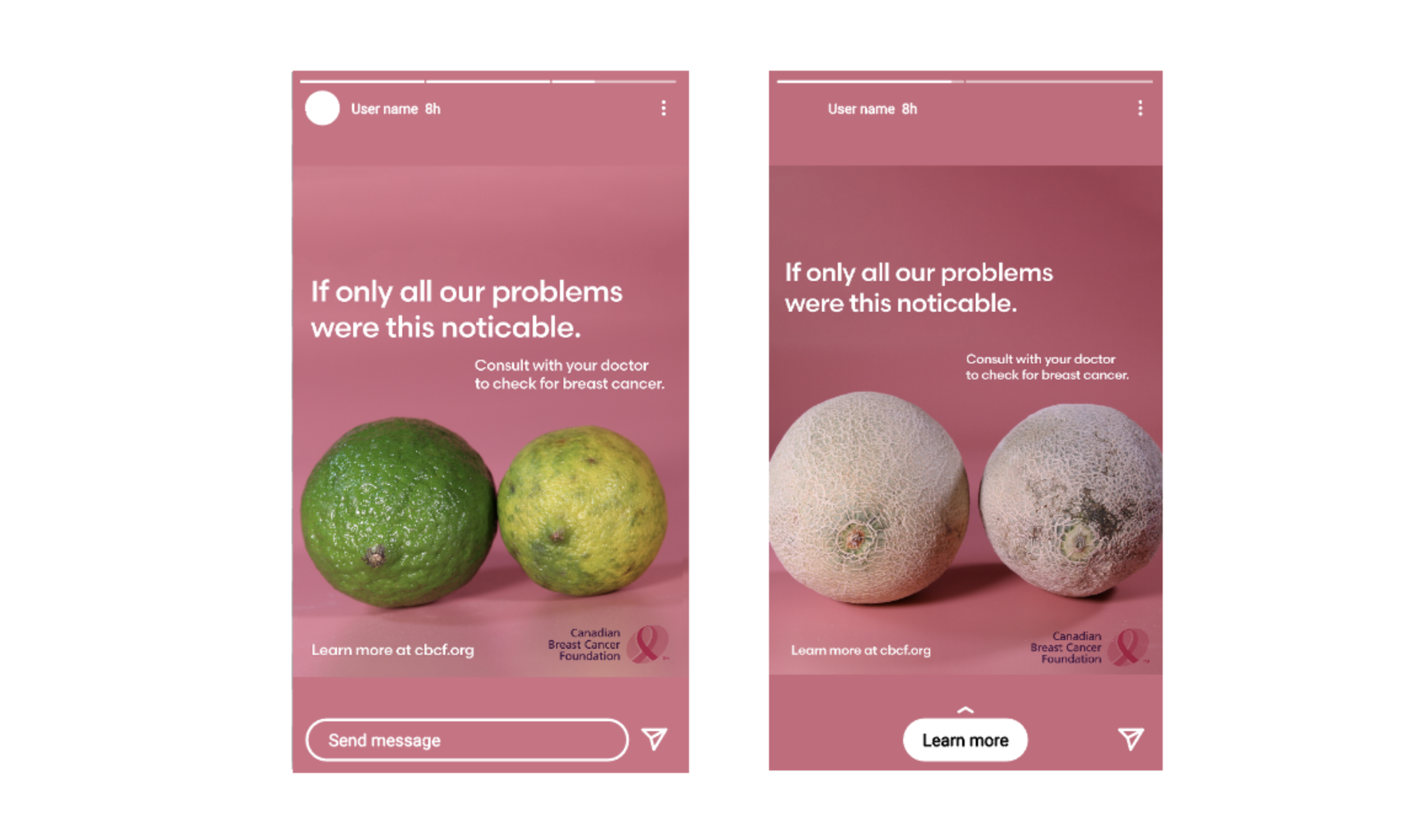 Breast Cancer Fruit Campaign