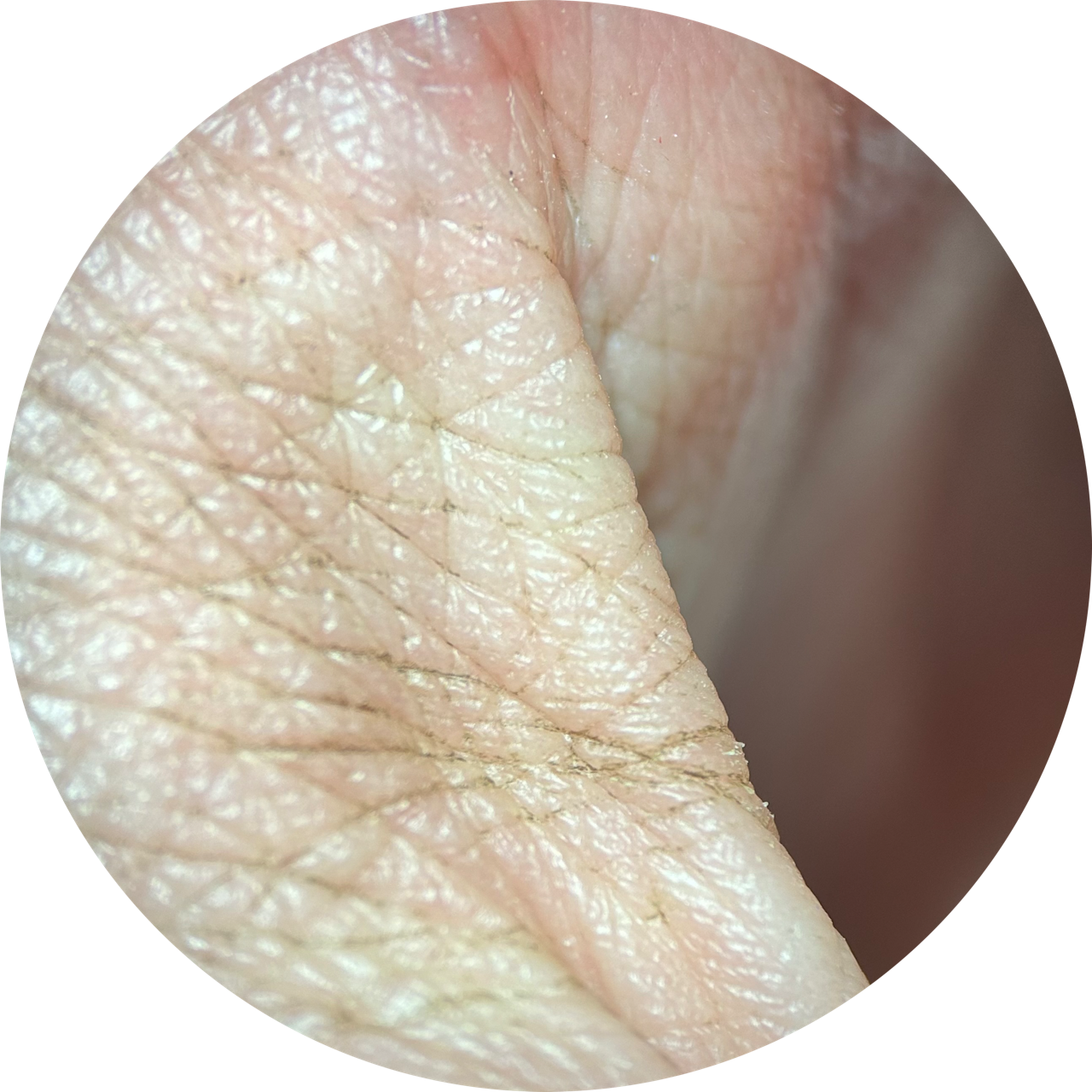 Thumb Web at 20x Magnification