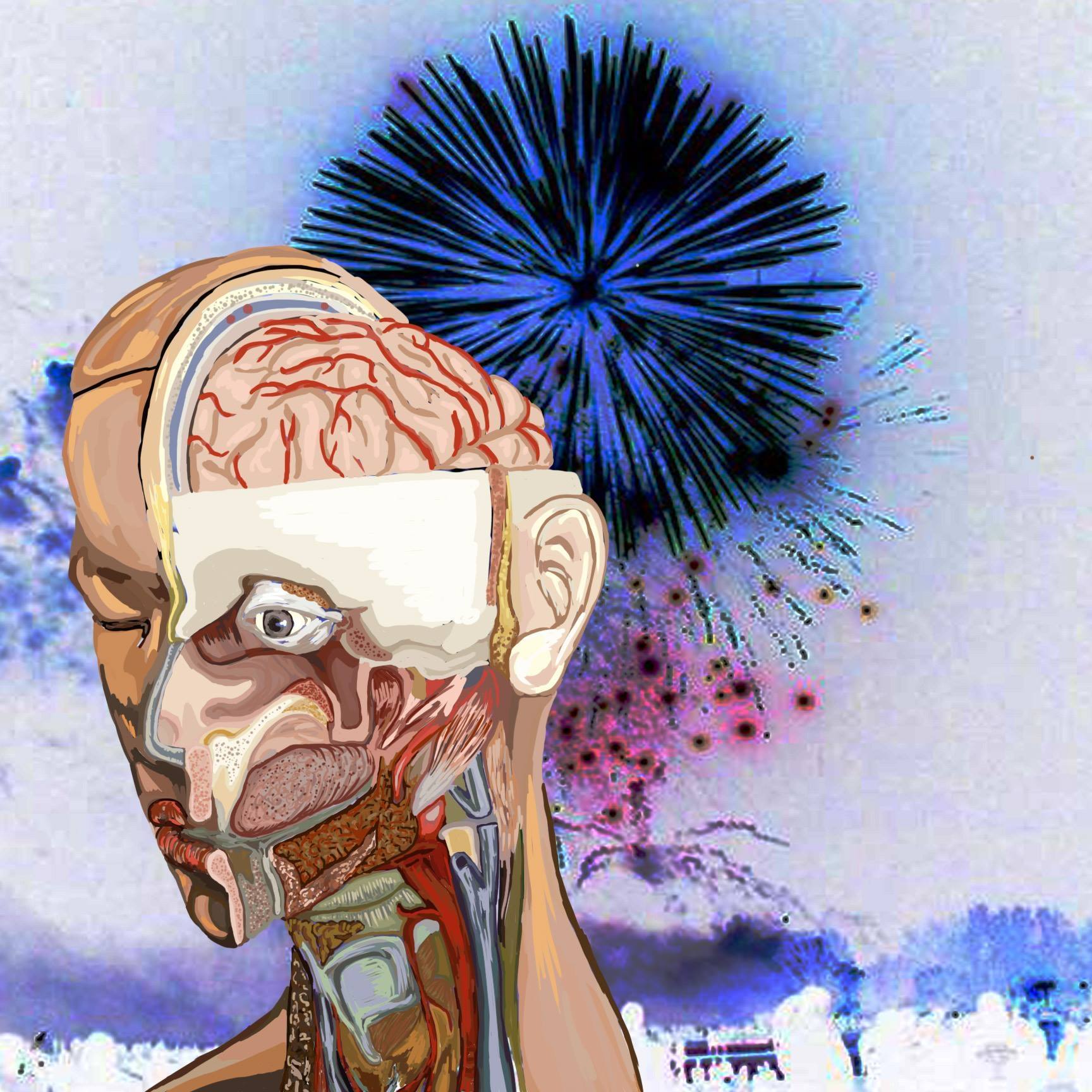 Brain Explosions