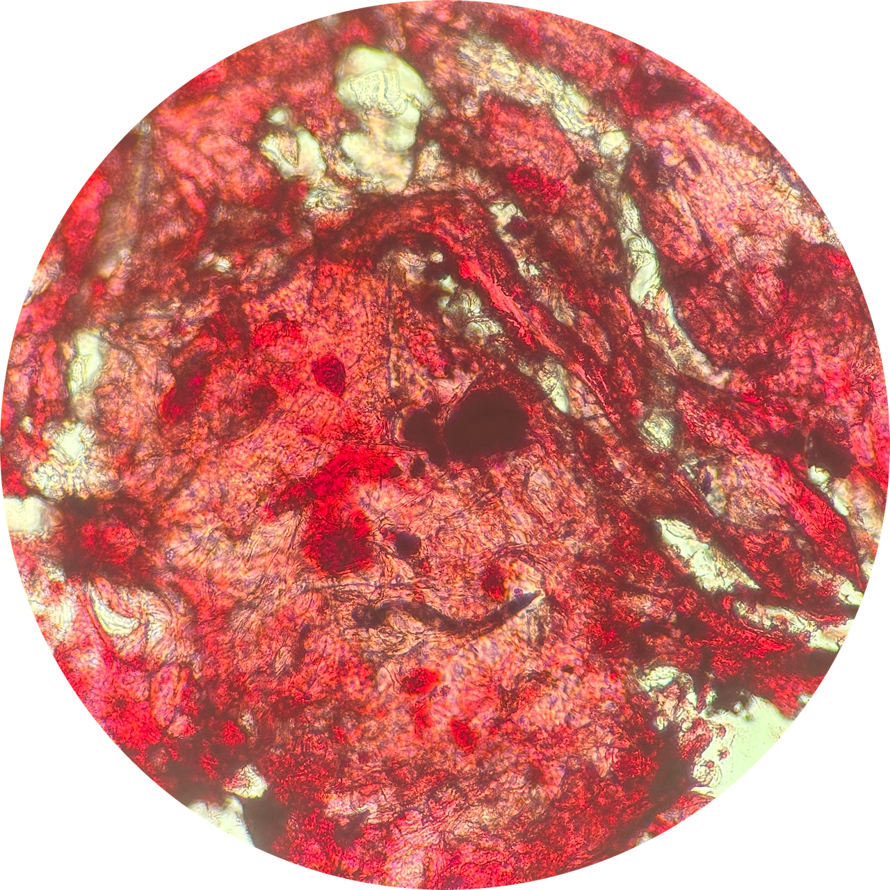 Cheek Swab at 100x Magnification