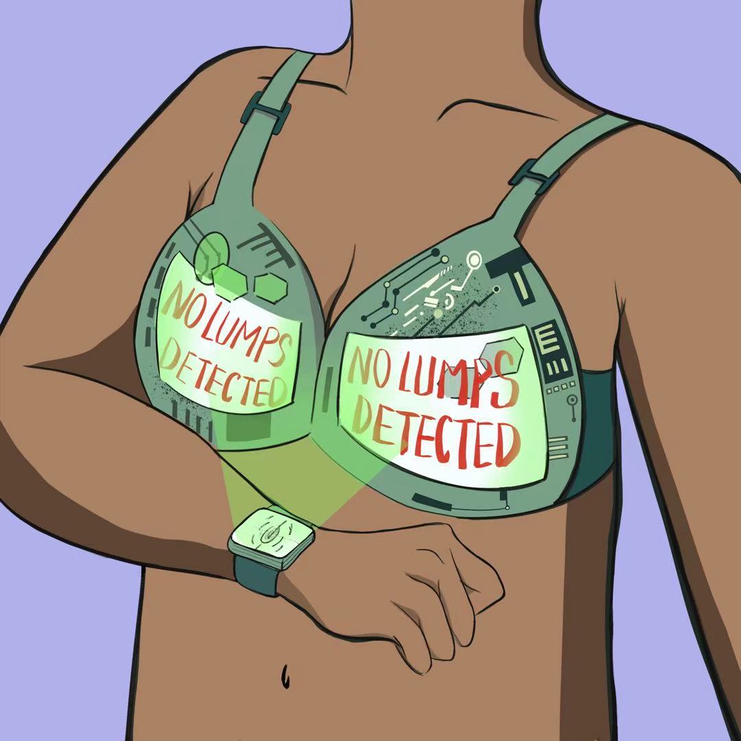BreastGuard