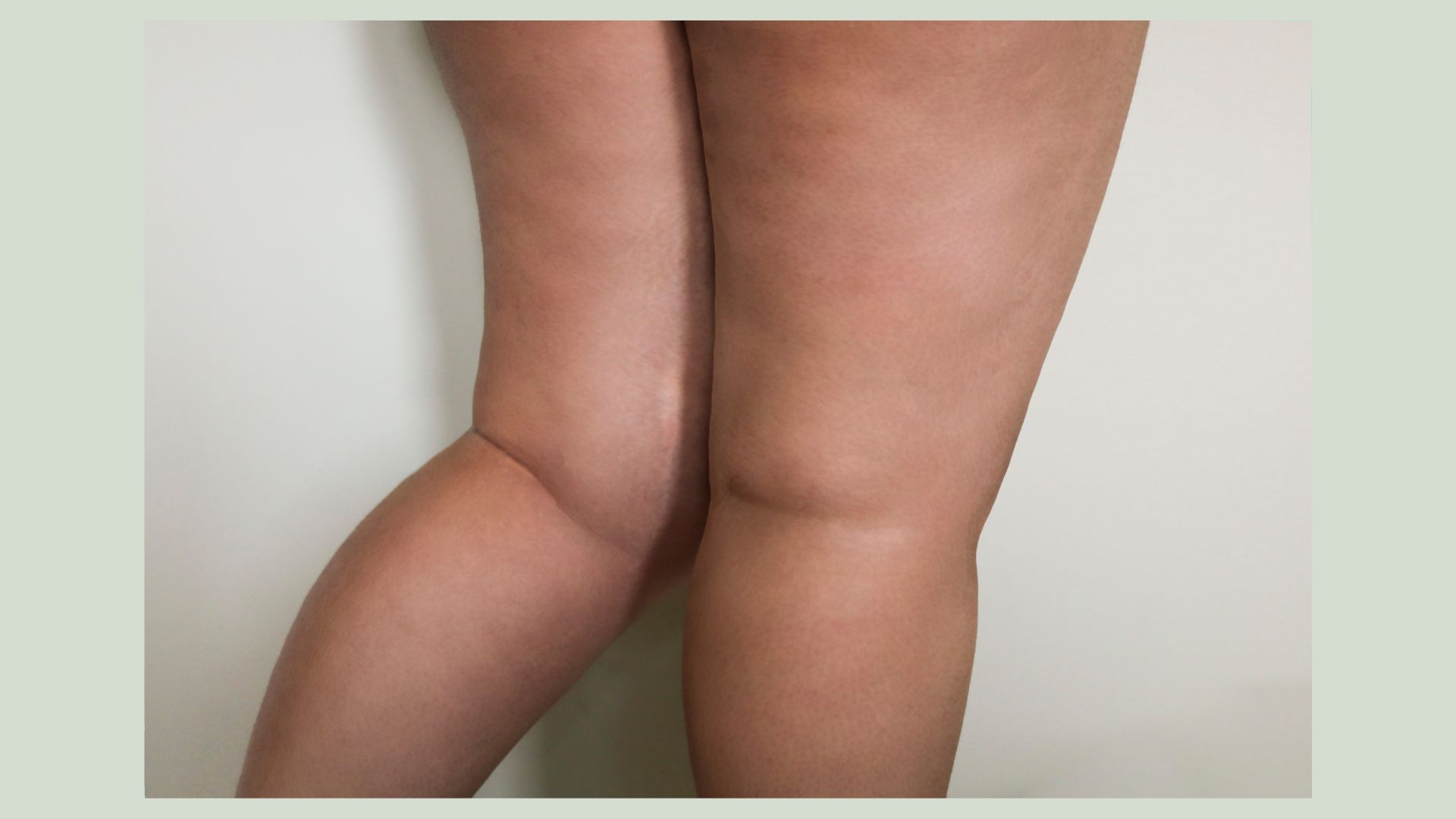 Viewer Reflection is Advised