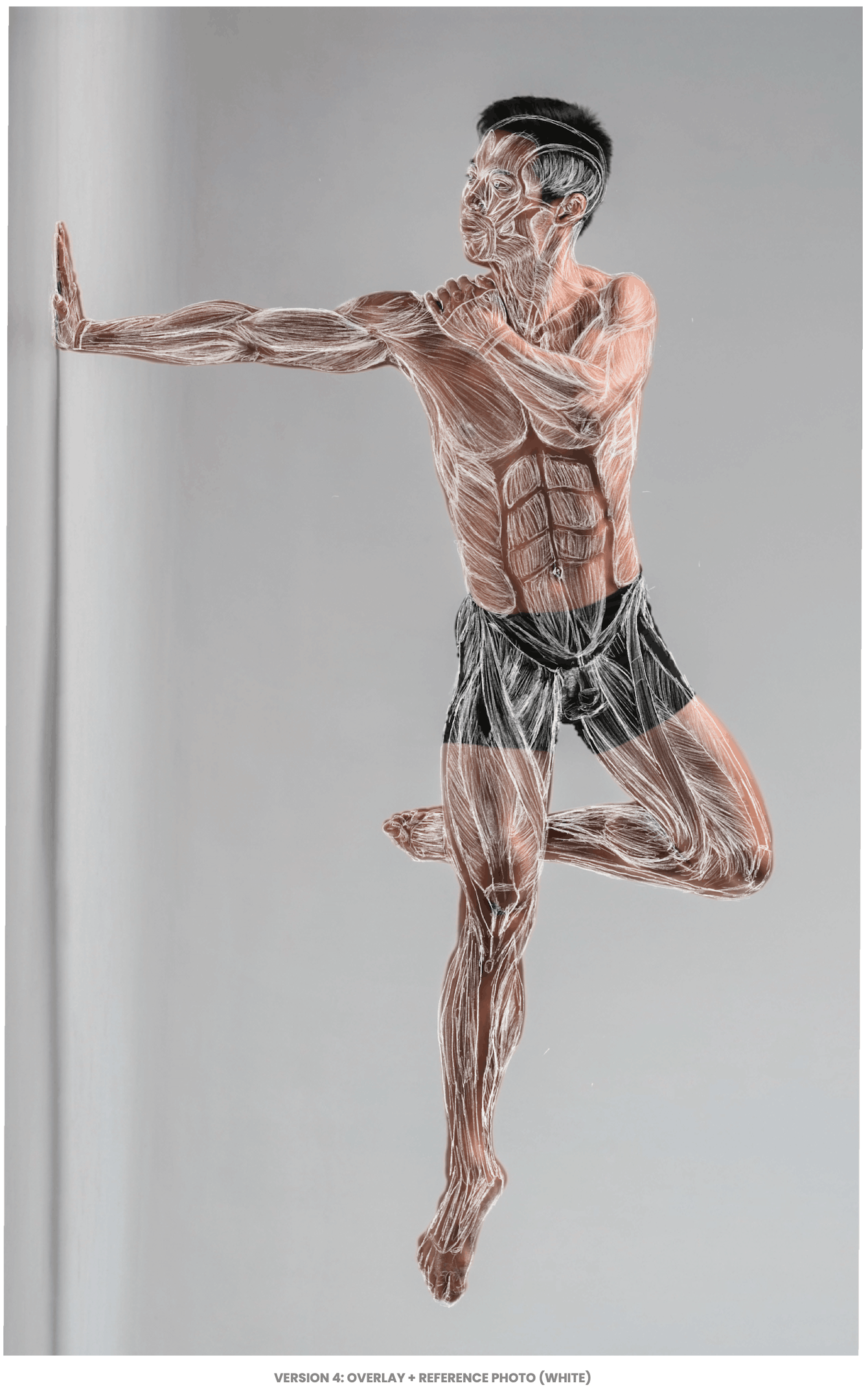 ¹² Skeletal & MSK Analysis
