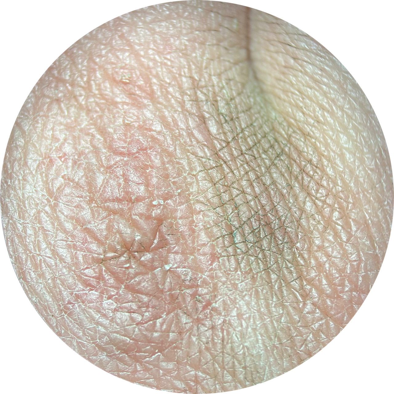 Knuckle at 20x Magnification