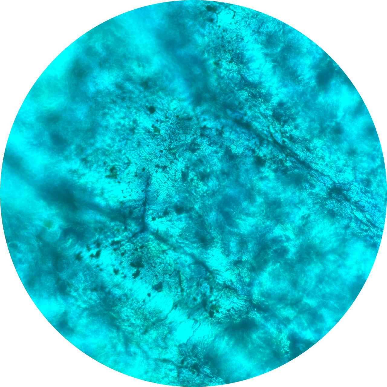 Blister at 400x Magnification