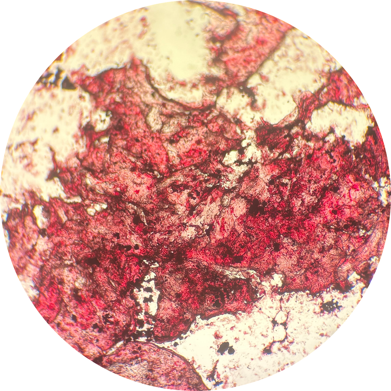 Cheek Swab at 40x Magnification