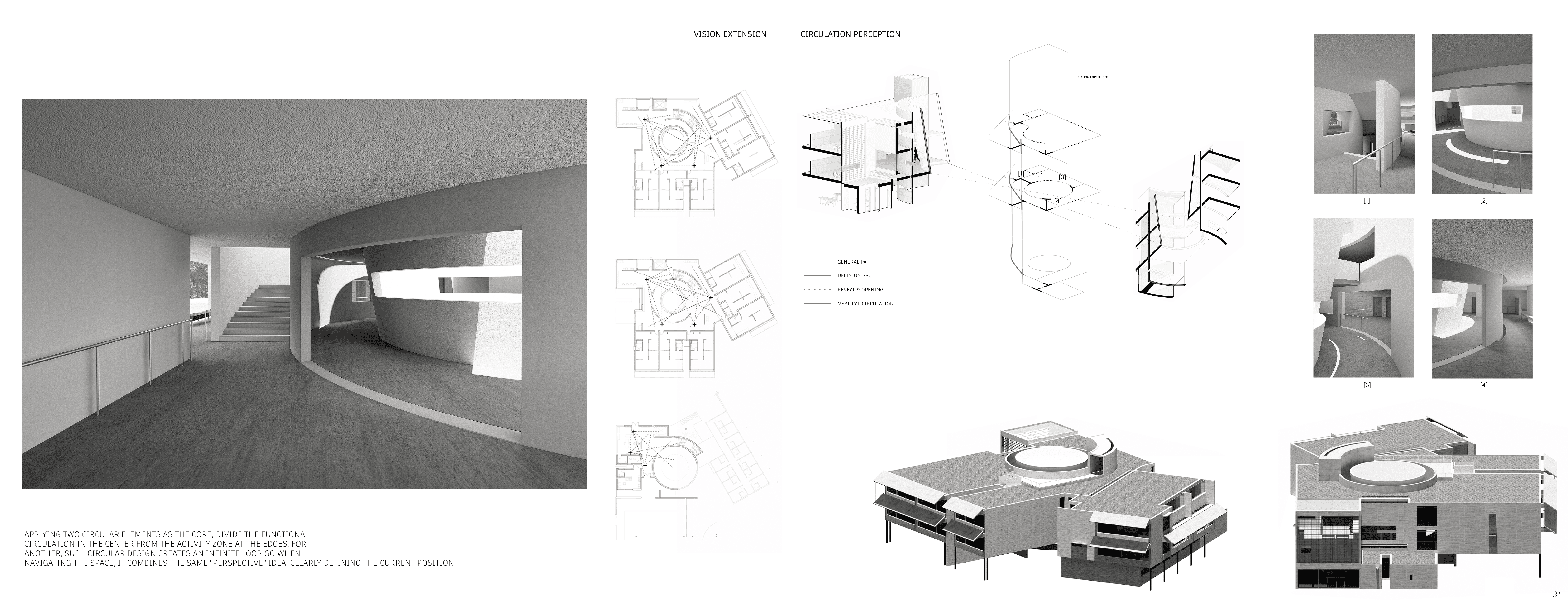 Alzheimer Complex