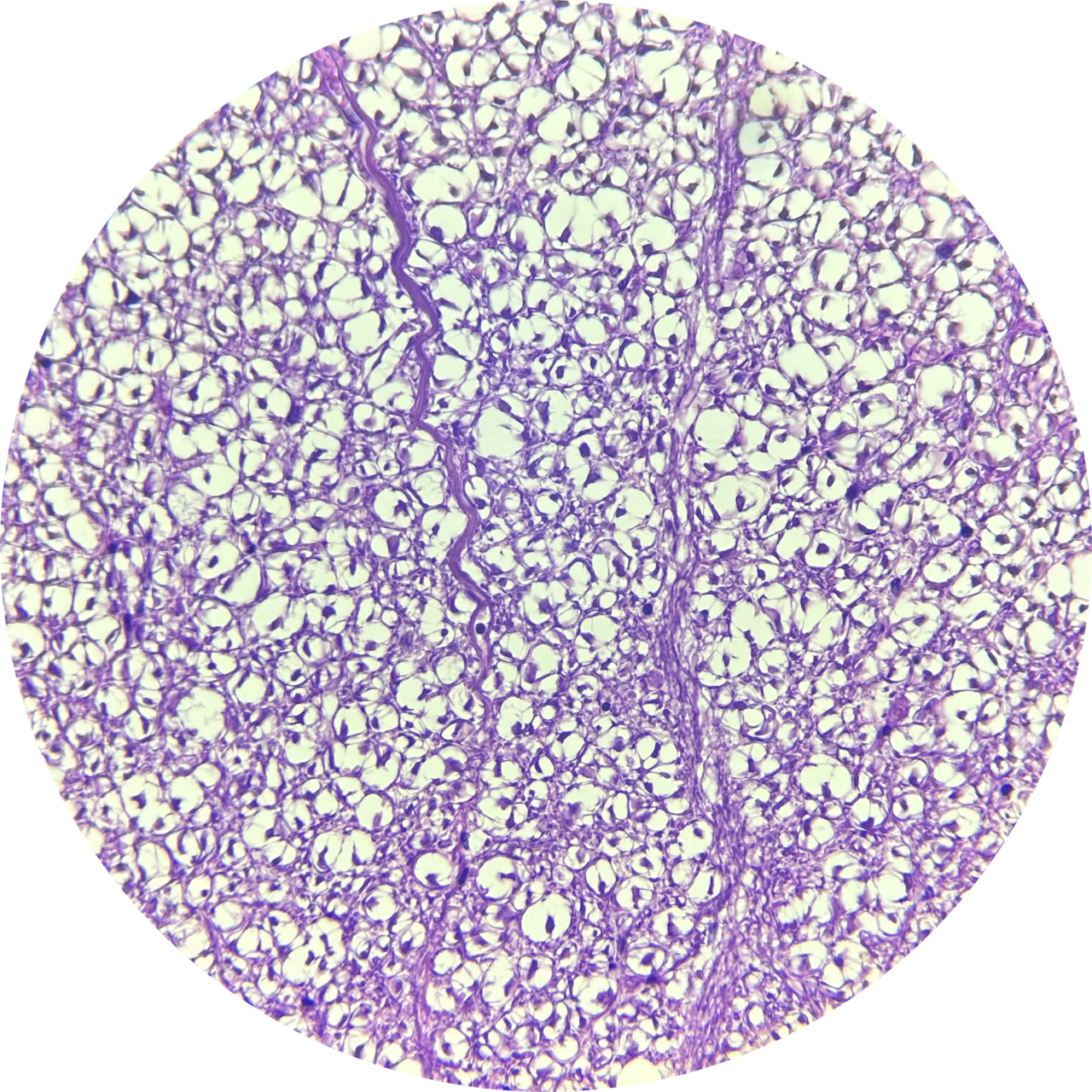 Spinal Cord Mammal at 400x Magnification, 93-3683