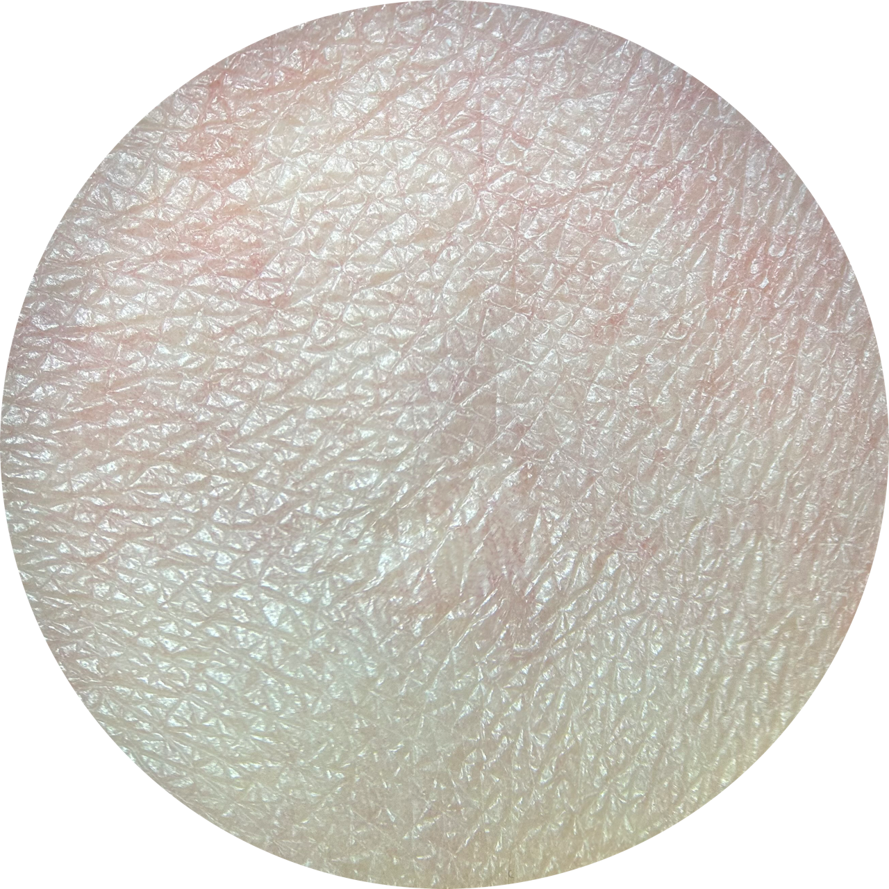 Skin at 20x Magnification