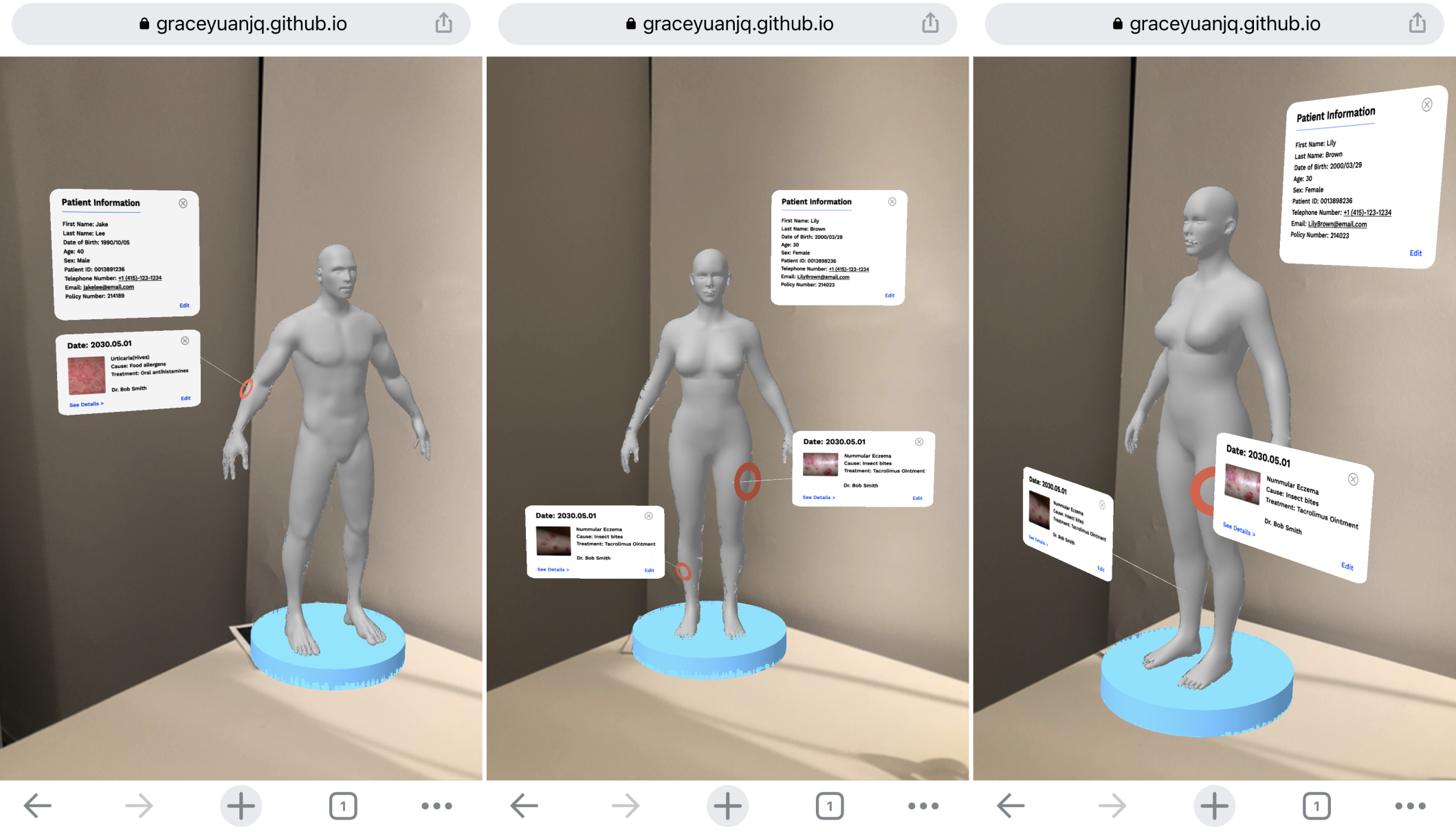 MR-Medicine: Improving Telemedicine Video Consultation with Mixed Reality and User Experience Design