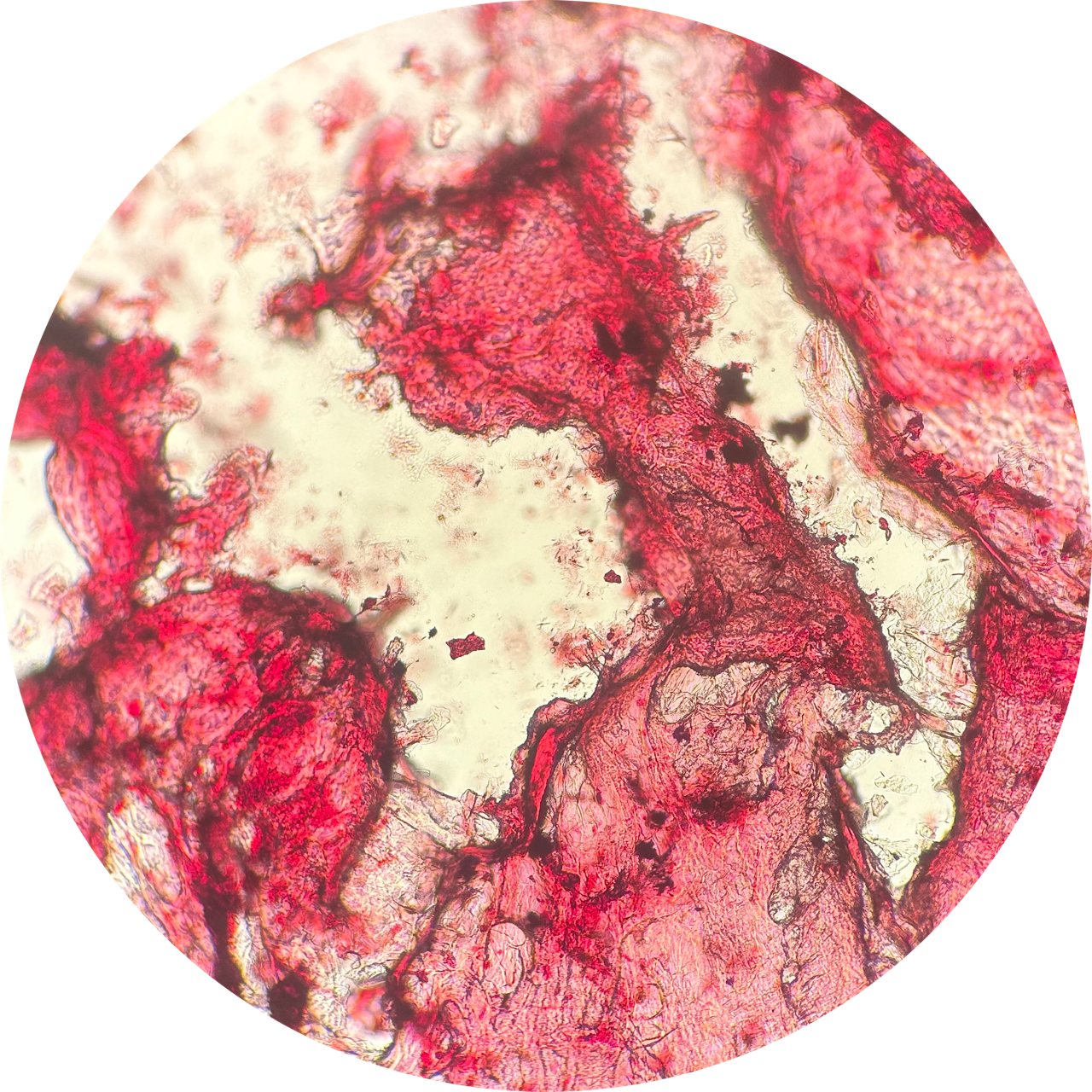 Cheek Swab at 100x Magnification