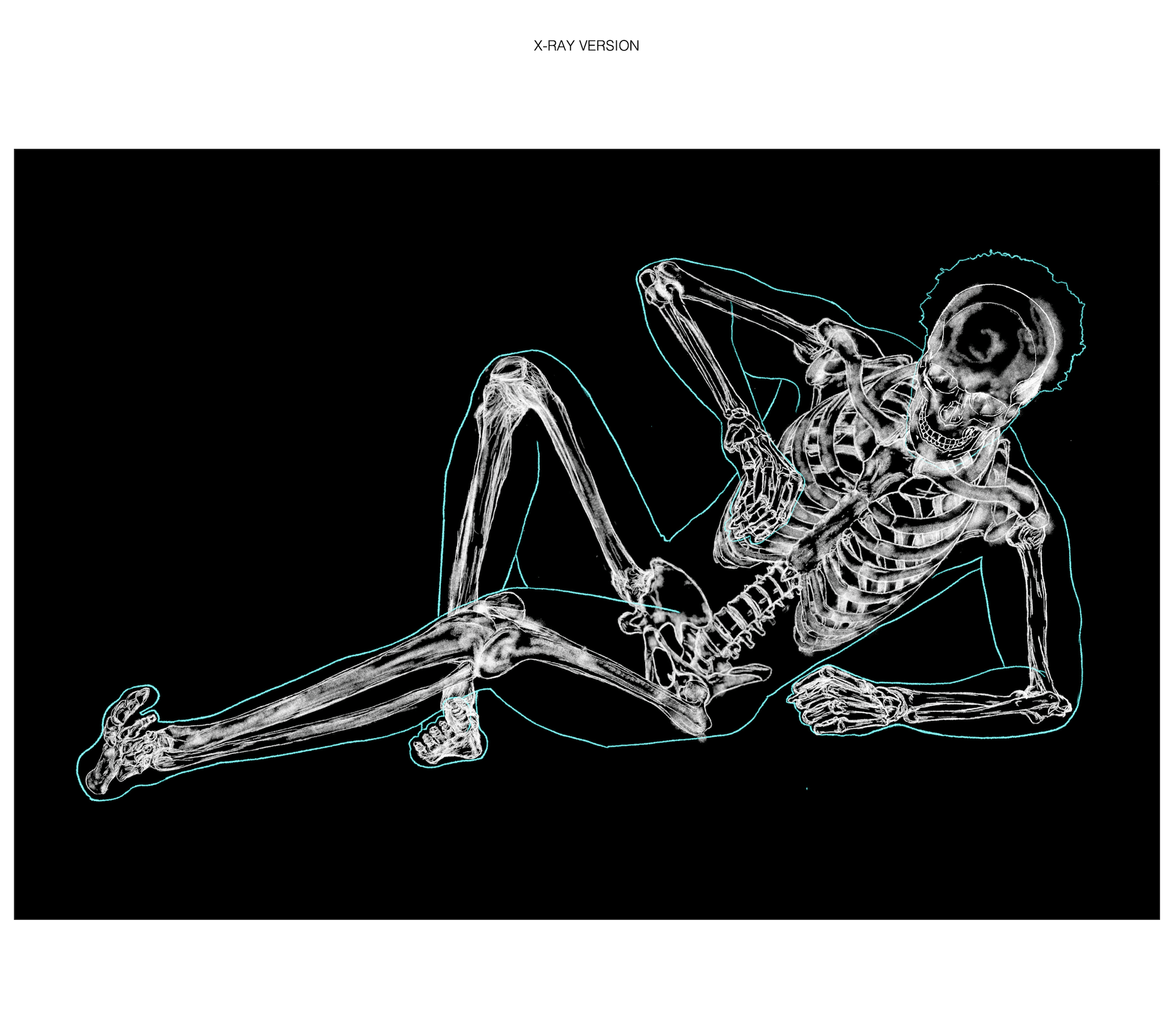 ¹² Skeletal & MSK Analysis