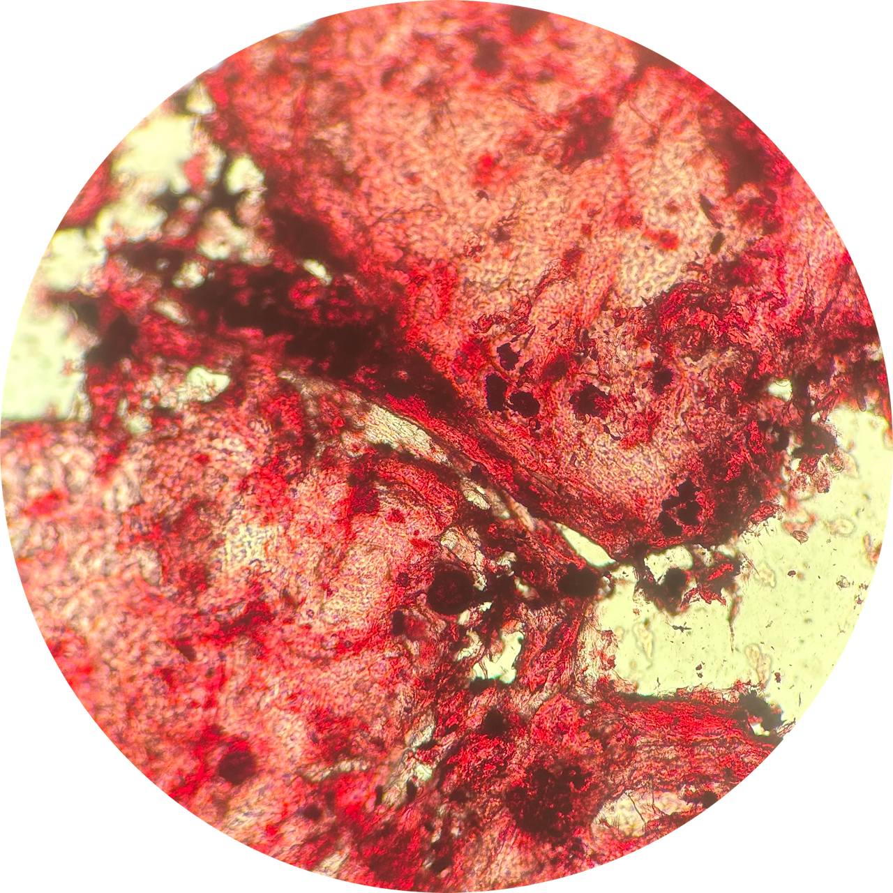 Cheek Swab at 100x Magnification