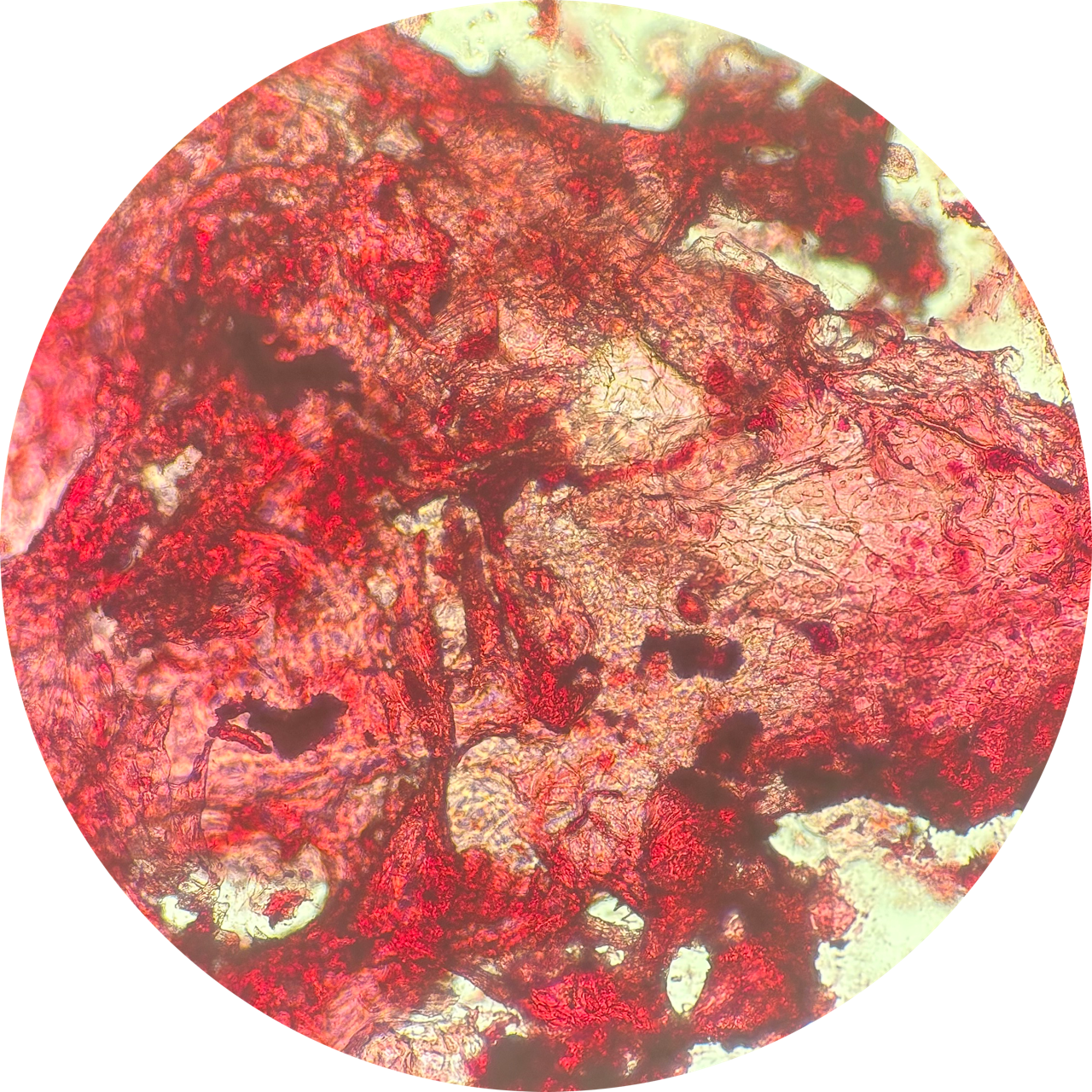 Cheek Swab at 100x Magnification