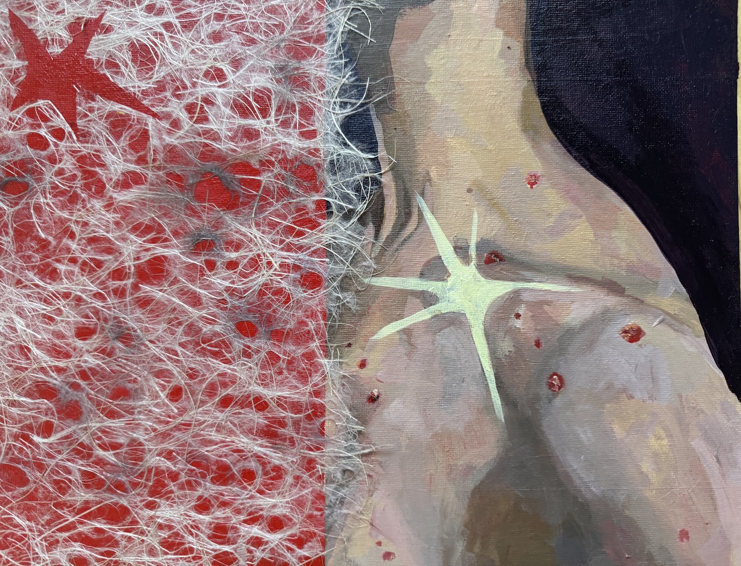 MY SCABS ARE NOT CRATERS