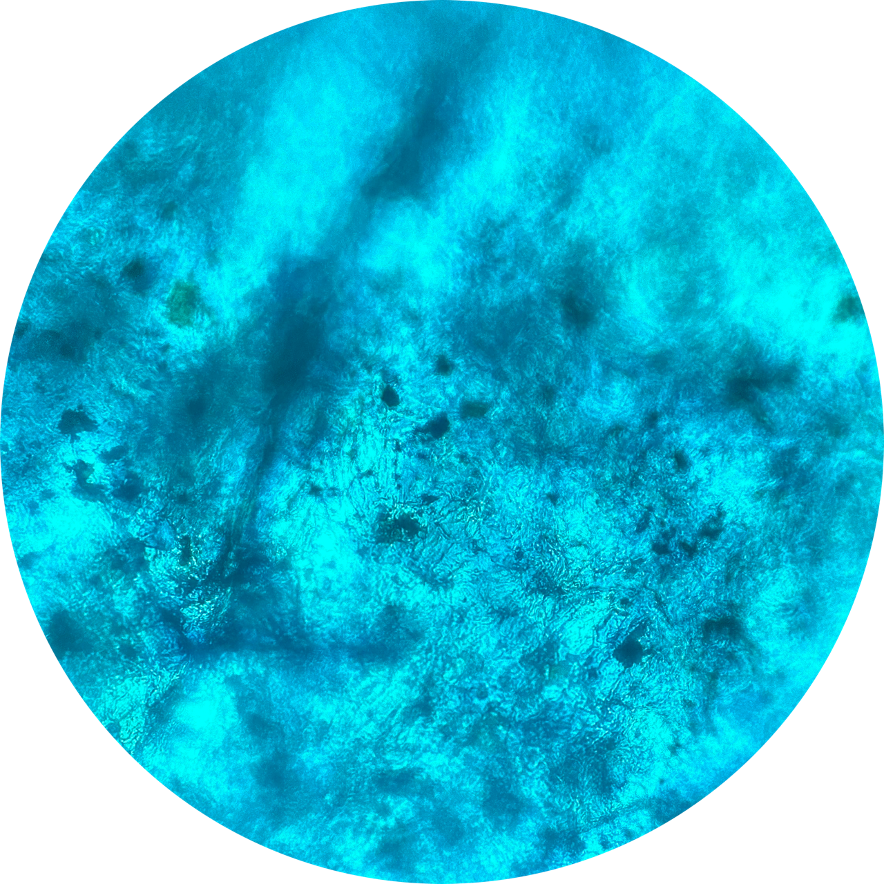 Blister at 400x Magnification