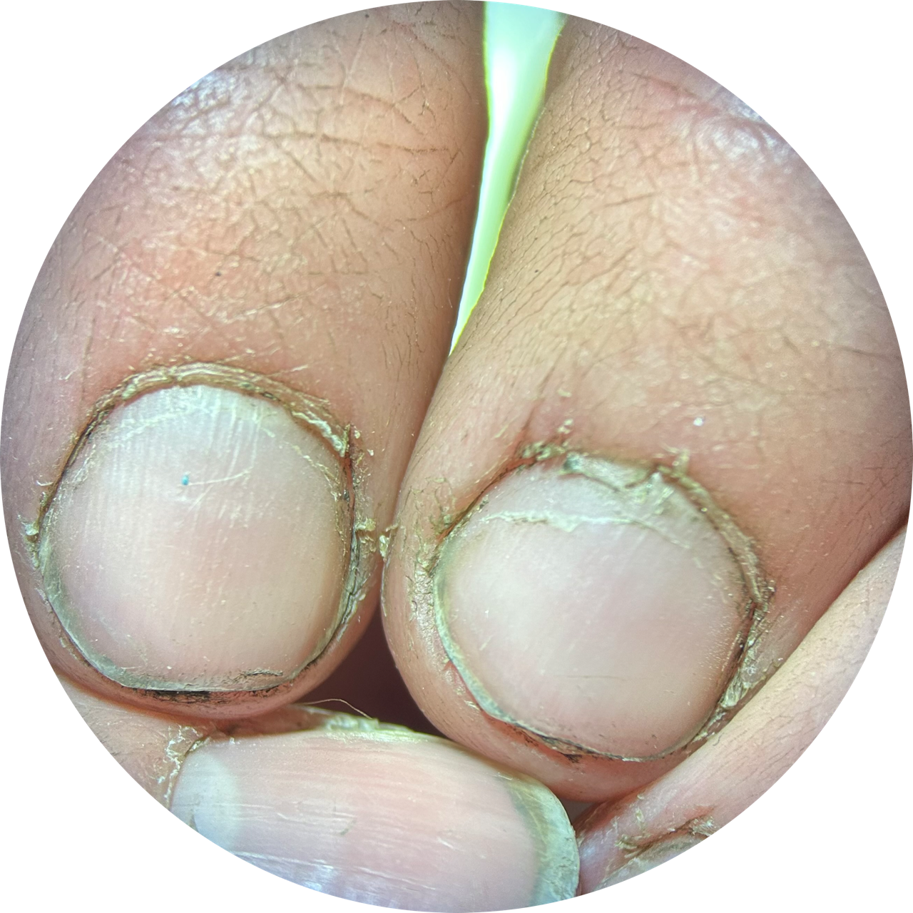 Fingernails at 20x Magnification