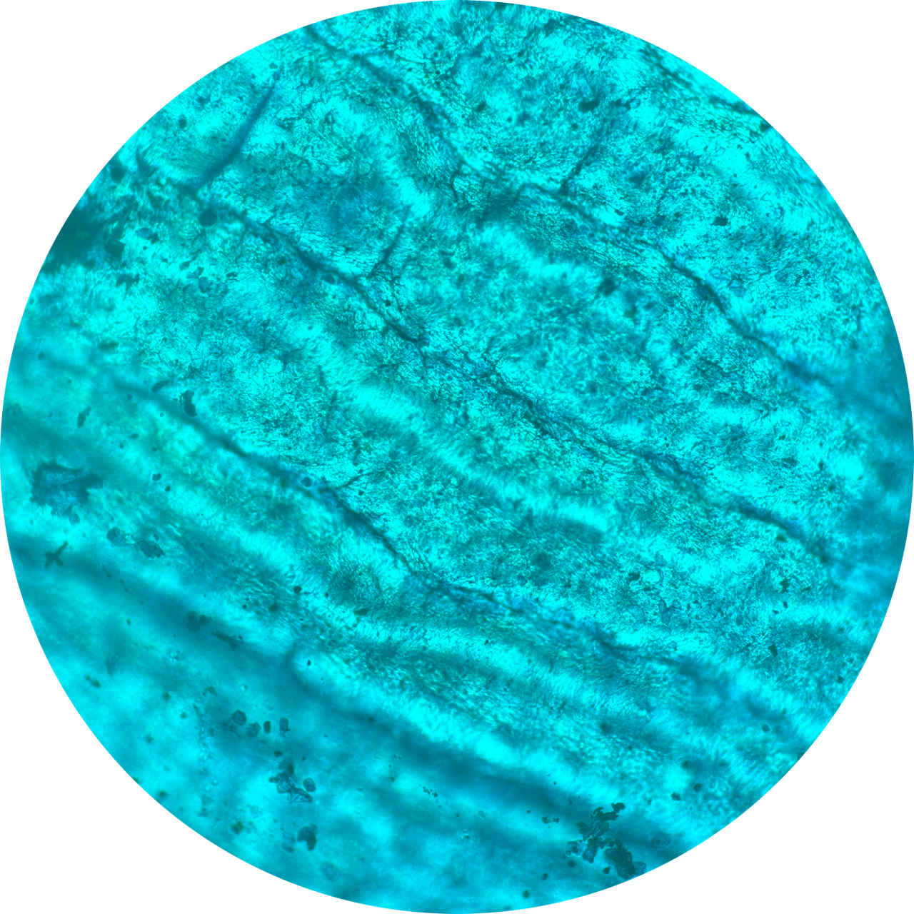 Blister at 100x Magnification