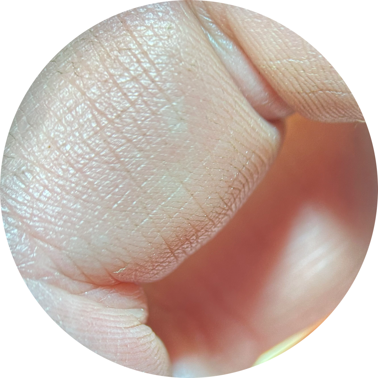 Finger at 20x Magnification