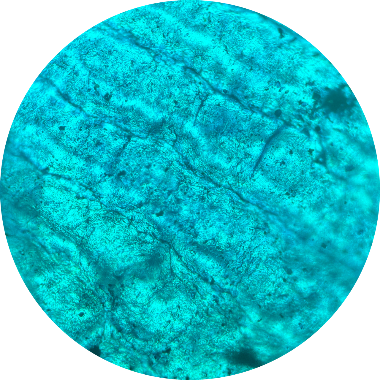 Blister at 100x Magnification