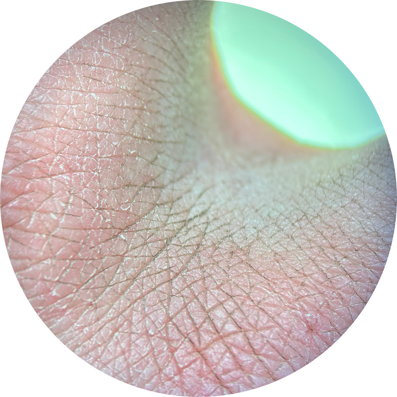 Finger Web at 20x Magnification