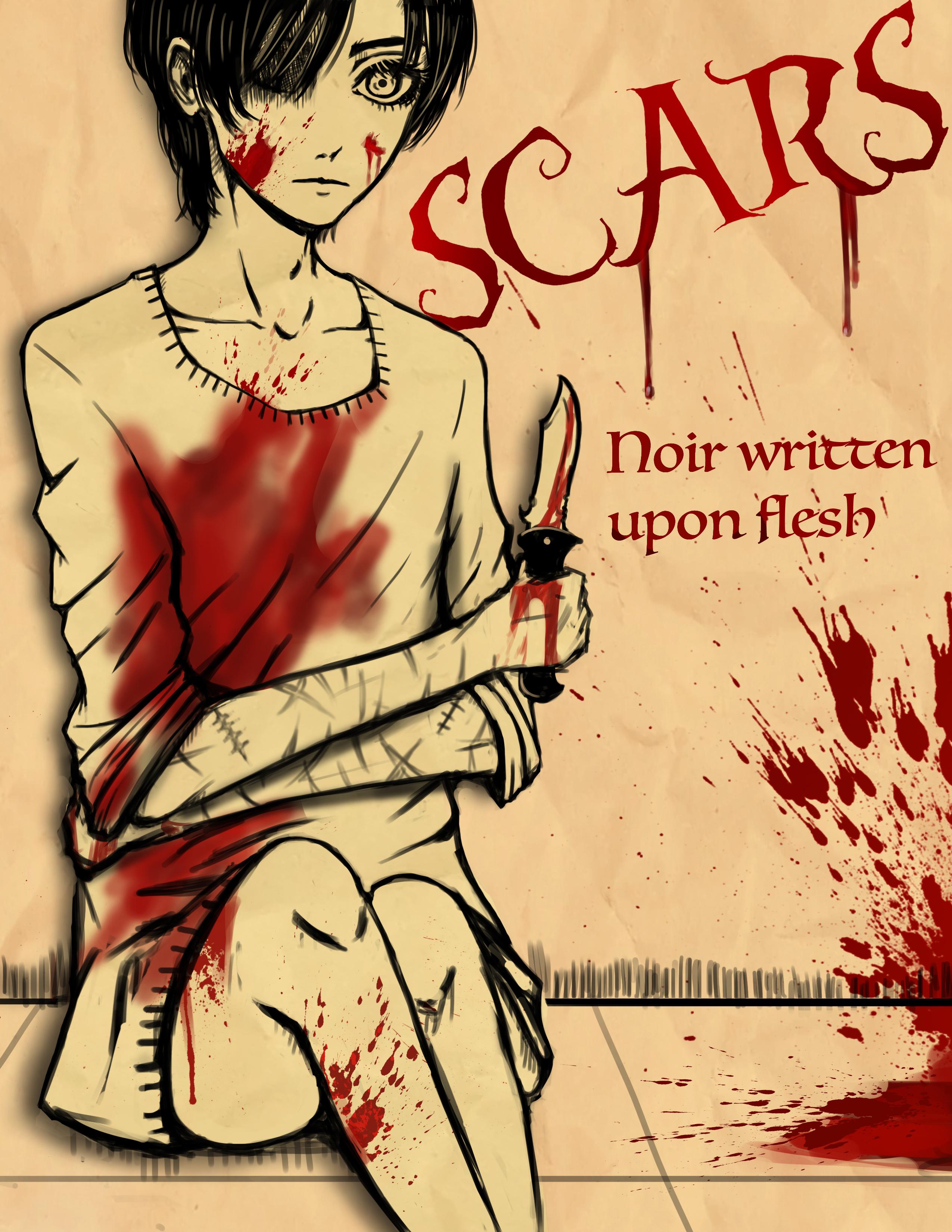 Scars