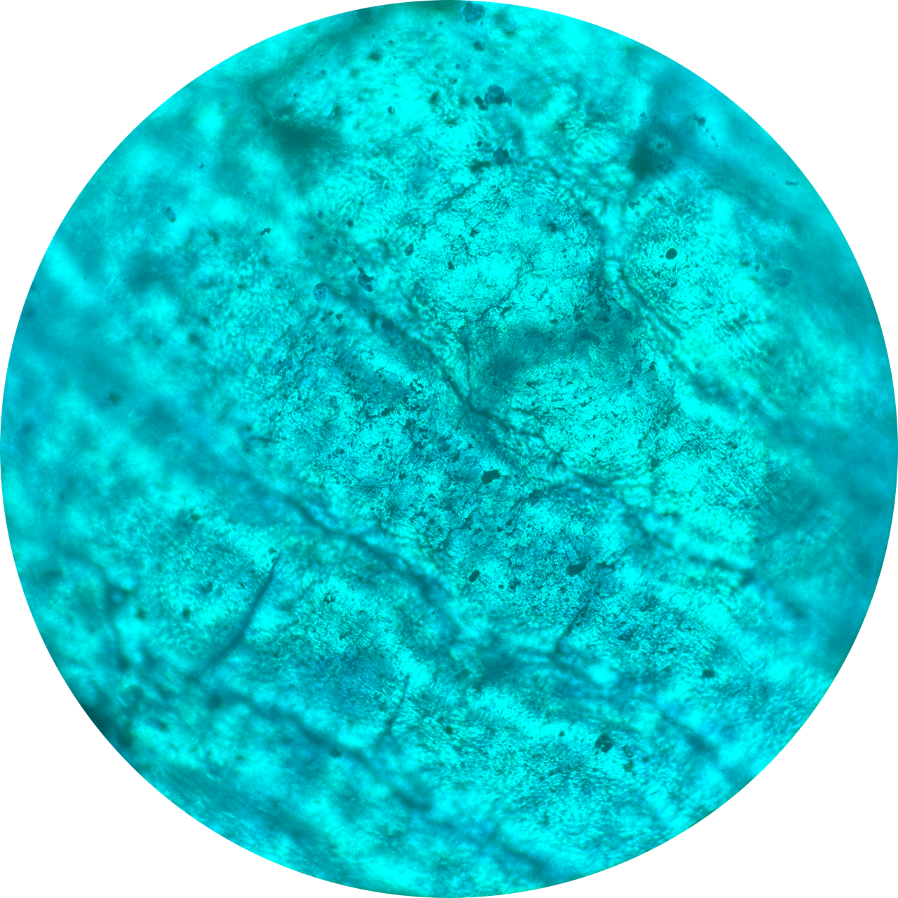 Blister at 100x Magnification