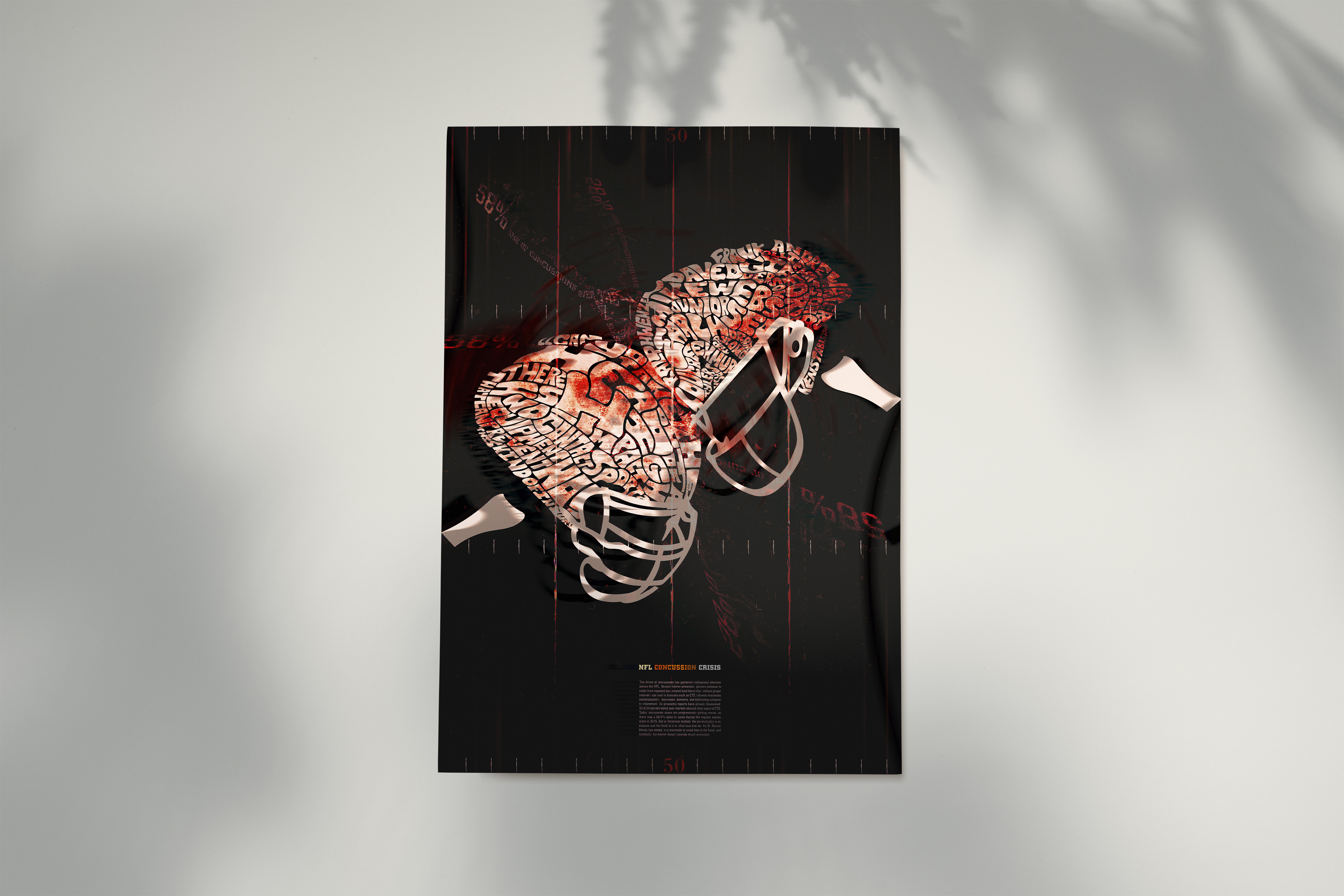 NFL CONCUSSION CRISIS