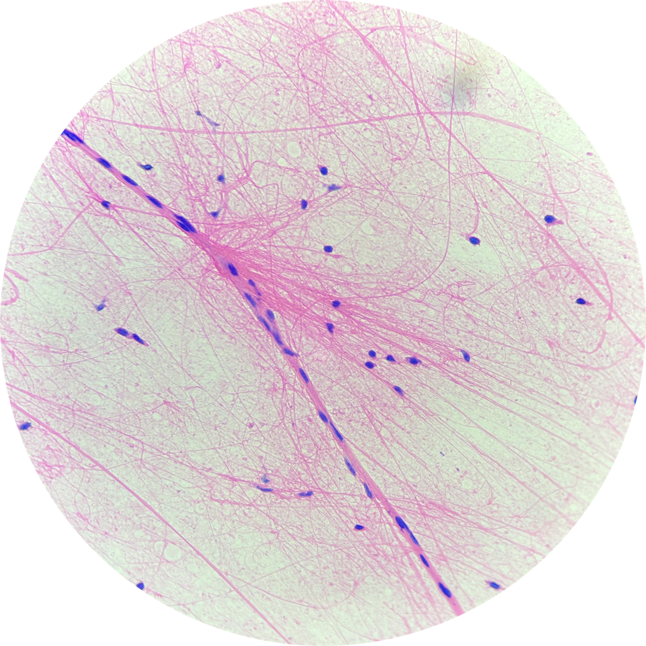 Spinal Cord (Mammalian) at 400x Magnification, 93-3617