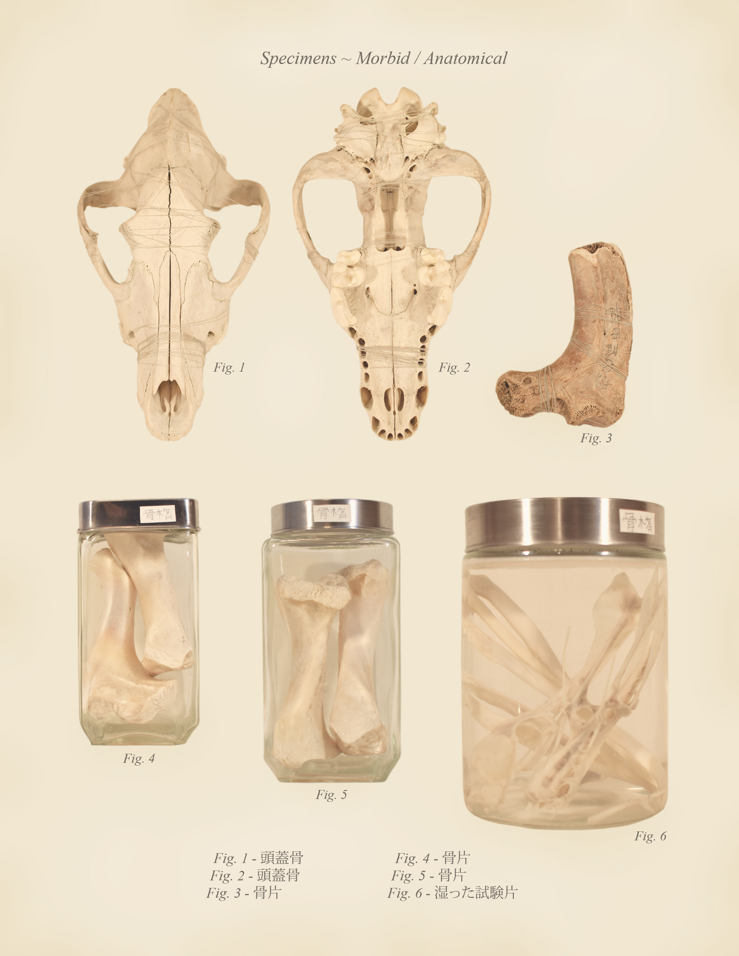 Specimens ~ Morbid / Anatomical
