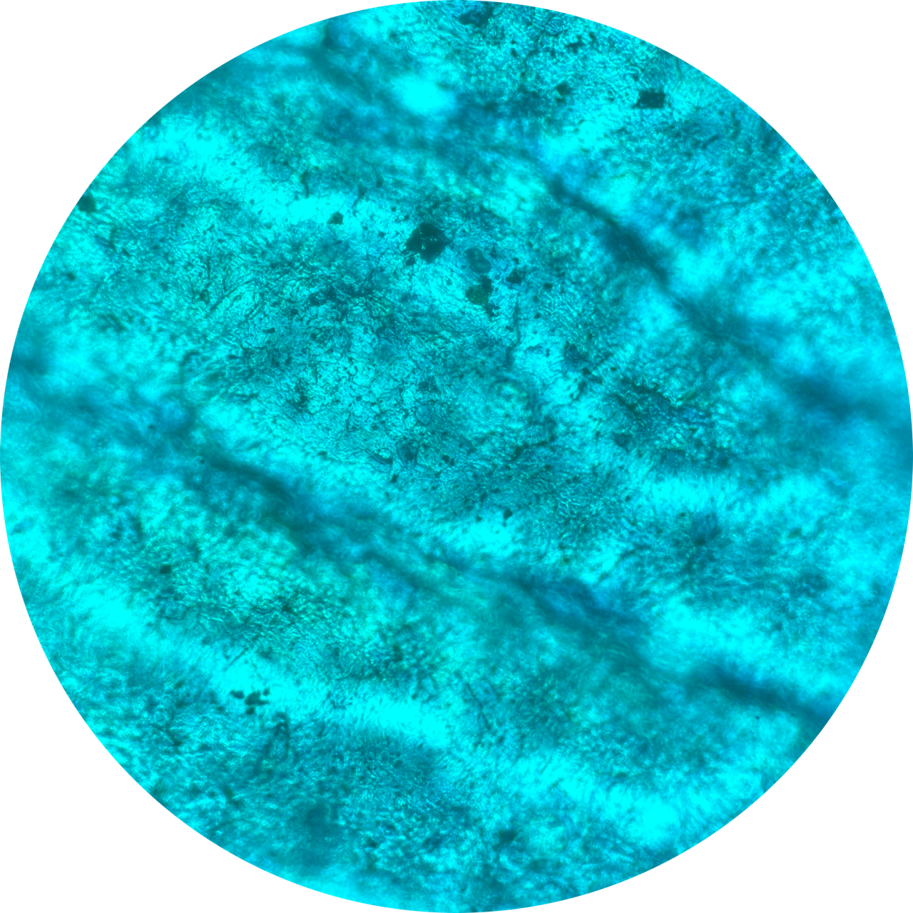 Blister at 400x Magnification