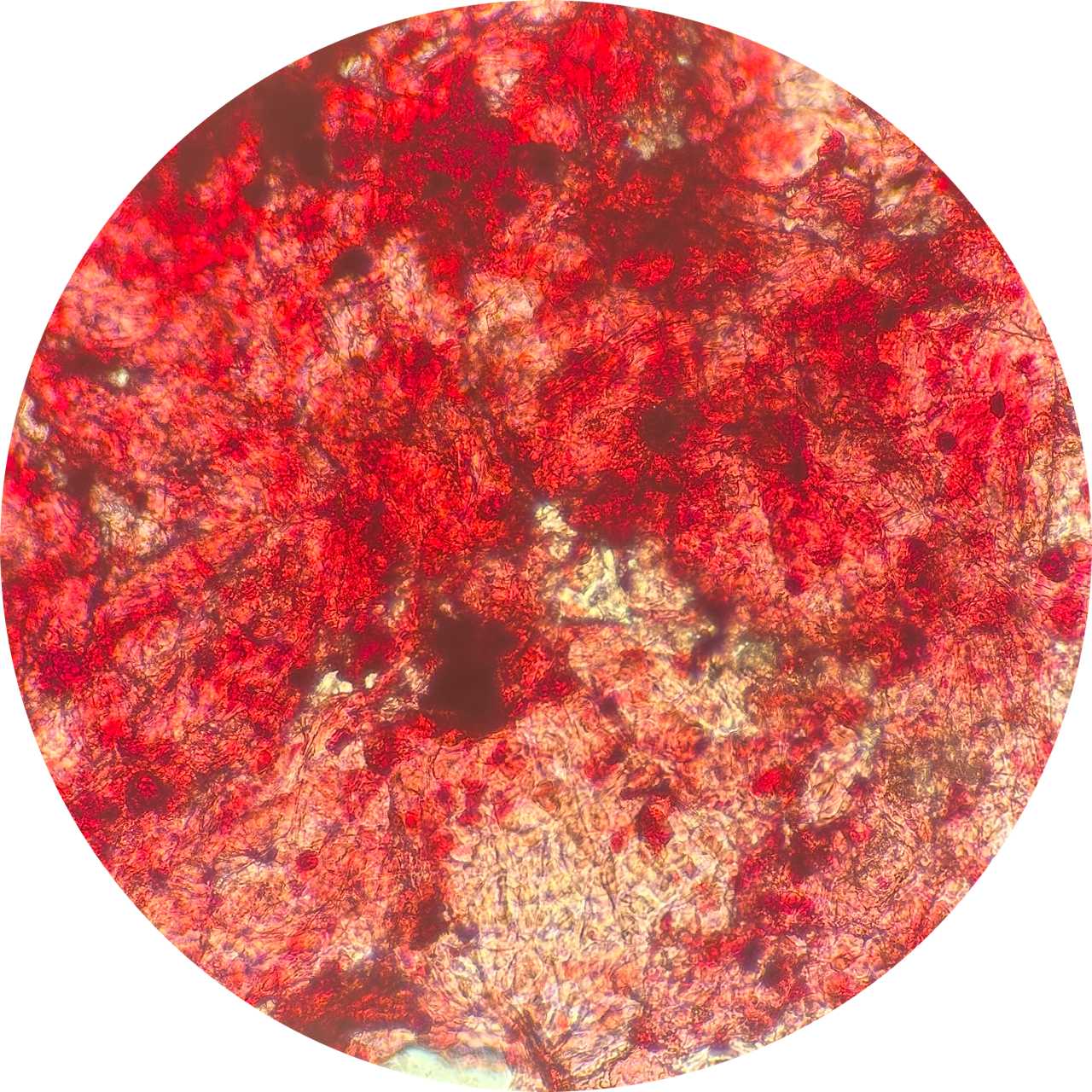 Cheek Swab at 100x Magnification