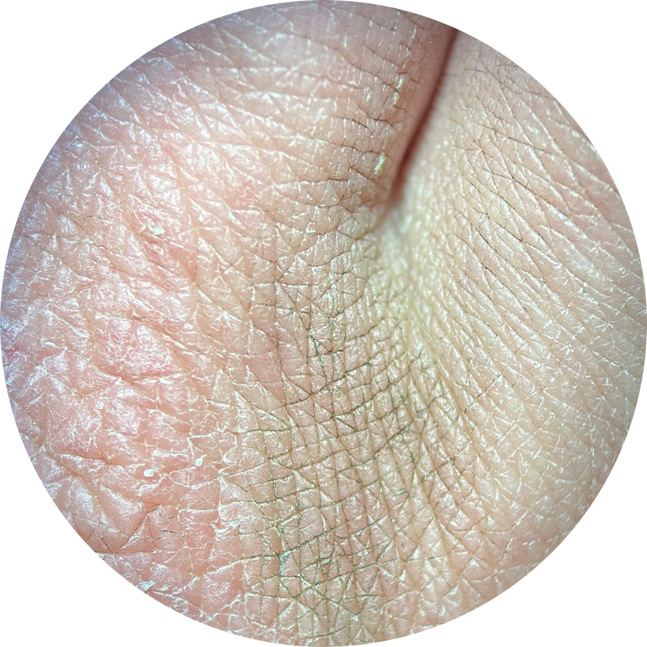 Knuckle at 20x Magnification