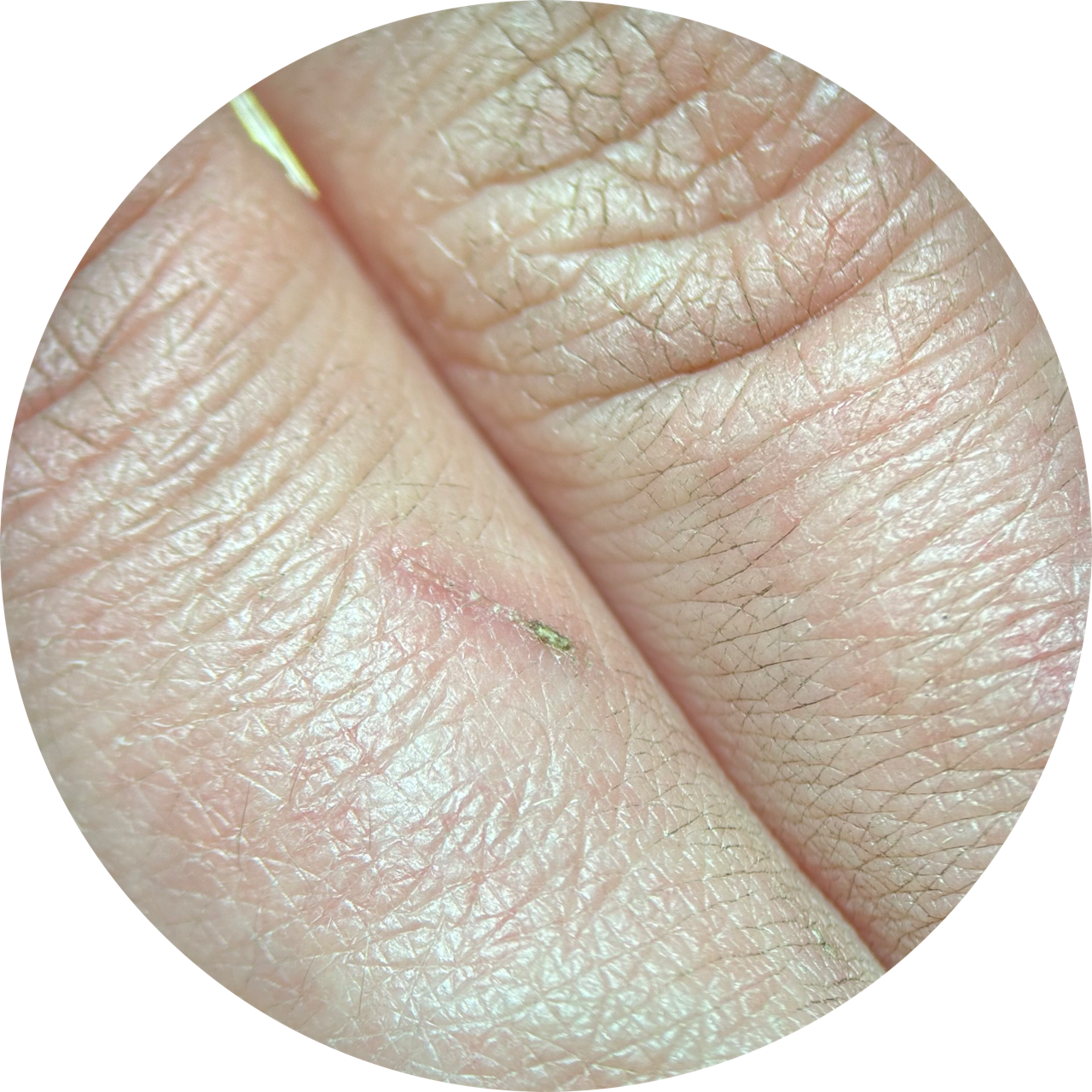 Fingers at 20x Magnification