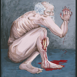 An Unscratchable Itch