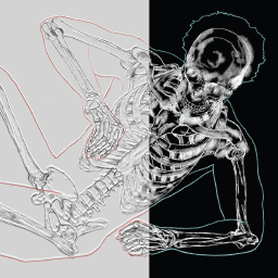 ¹² Skeletal & MSK Analysis