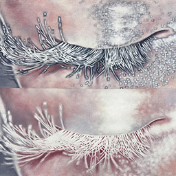 Mitosis